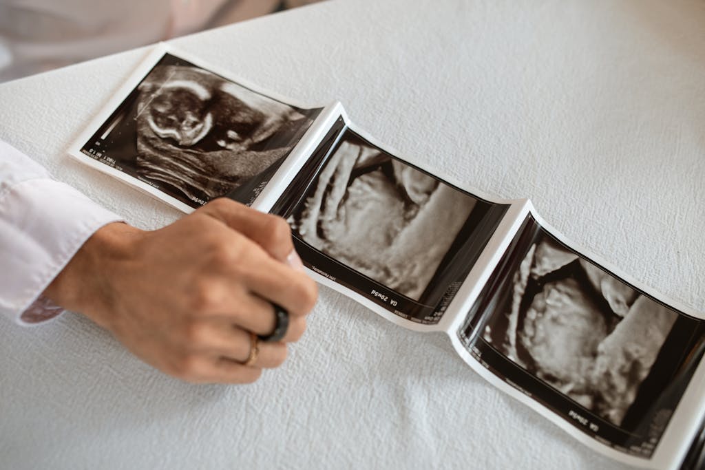 A hand holding a series of ultrasound images, symbolizing new beginnings and family planning.