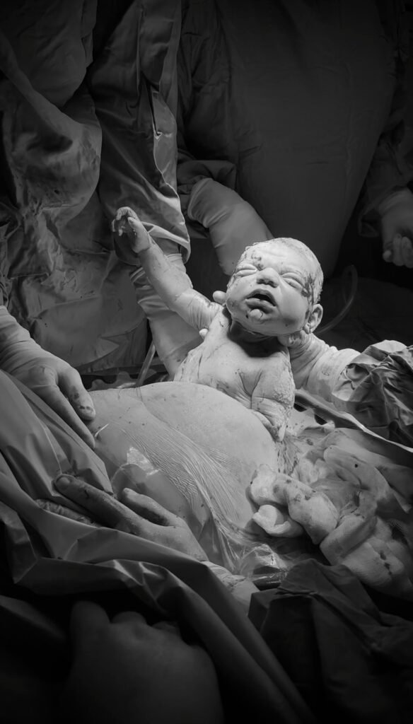 Somerset Maternity cesarean birth story